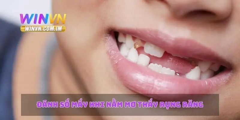 Đánh số mấy khi nằm mơ thấy rụng răng